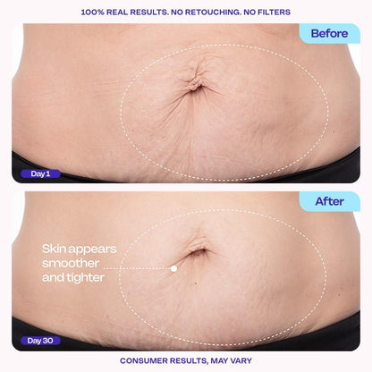 Lose The Loose Look— visible improvement in just weeks