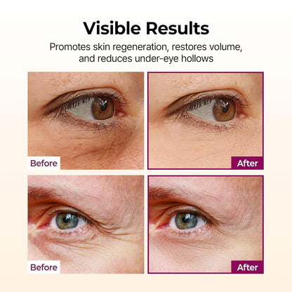 Rebuild Skin Elasticity Layer by Layer With Targeted Multi-Collagen