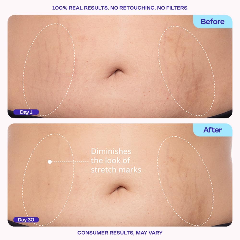 Lose The Loose Look— visible improvement in just weeks