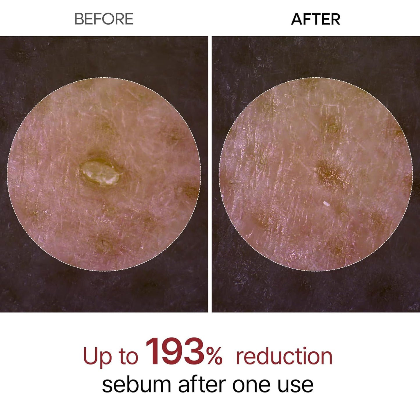 Melt Blackheads & Cleanse Clogged Pores Instantly for Flawless Glass Skin