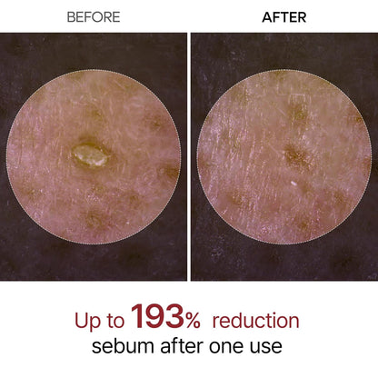 Melt Blackheads & Cleanse Clogged Pores Instantly for Flawless Glass Skin